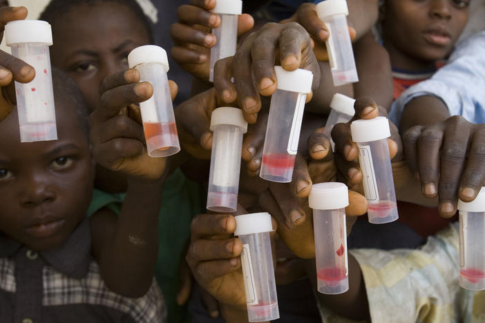 Children in Nasarawa, Nigeria, hold samples of their urine specimens. Blood in the urine is a sign of Schistosomiasis, a microscopic worm that, left untreated, can damage organs as well as cause learning delays. A new pill has been developed to treat preschoolers.