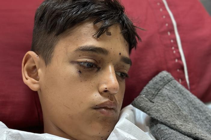 Fourteen-year-old Mohammed Abu Samur found what he thought was a bottle of perfume or deodorant. He lost his left hand below the elbow, and all the fingers on his right hand.