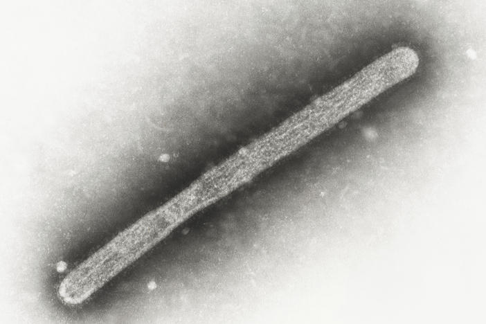 This 2005 electron microscope image shows an avian influenza A H5N1 virion. On Wednesday, Michigan health officials said a farmworker has been diagnosed with bird flu, the second human case connected to an outbreak in U.S. dairy cows.
