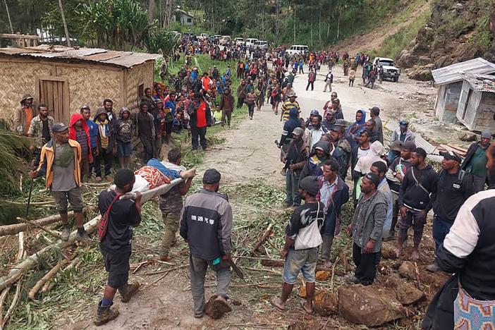 In this photo provided by the International Organization for Migration, an injured person is carried on a stretcher to seek medical assistance after a landslide in Yambali village, Papua New Guinea, Friday, May 24, 2024. More than 100 people are believed to have been killed in the landslide that buried a village and an emergency response is underway, officials said. 