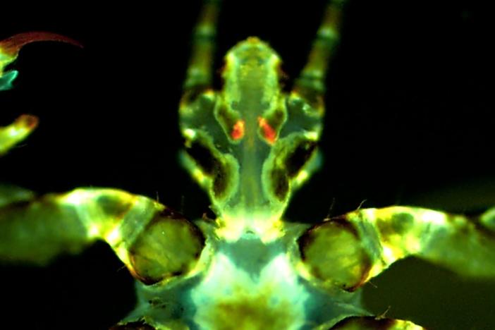 A fluorescent image of a human body louse with <em>Yersinia pestis</em> infection — that's the cause of the plague — depicted in orange/red in the glands.<br>