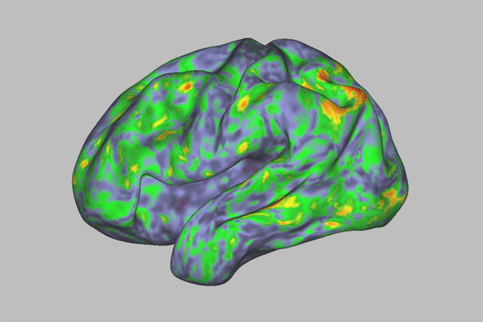 A study finds that psilocybin can desynchronize networks in the brain, potentially enhancing its plasticity.