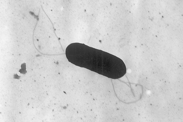 This 2002 electron microscope image from the Centers for Disease Control and Prevention shows a Listeria monocytogenes bacterium. Health officials have announced a recall of liverwurst and deli meat products in connection with a national listeria outbreak that has sickened nearly three dozen people in 13 states. 