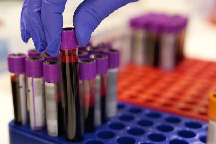New blood tests that help detect Alzheimer's disease are opening up a new era in diagnosis and treatment, doctors say.  