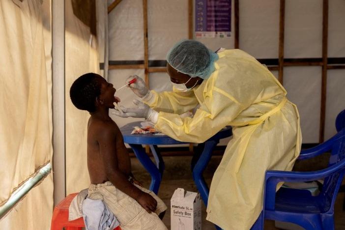 Nurse Christian Musema takes a sample from a child declared a suspected case mpox at the treatment center in Munigi in the Democratic Republic of Congo, where the virus has been surging. Cases have also been identified in four other countries in East Africa.