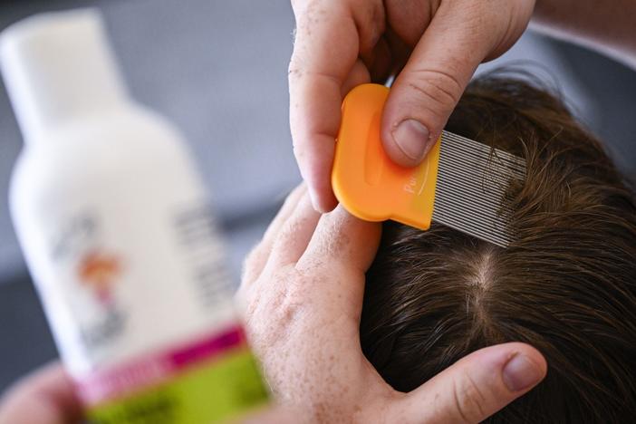 A child receives care against head lice.