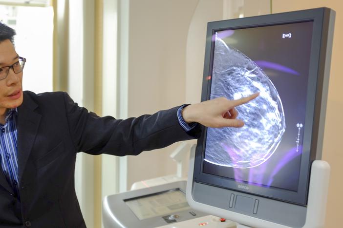 A doctor shows what a 3D image of the breast using tomosynthesis (3D mammography) looks like on a screen.
