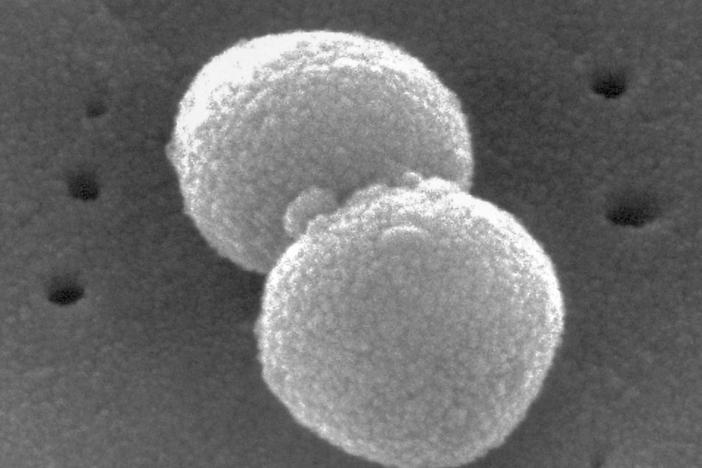 This electron microscopic image provided by the Centers for Disease Control and Prevention shows two, round-shaped, Gram-positive, Streptococcus pneumoniae bacteria.