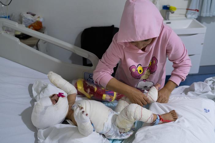 Ivana Likbiri, an 18-month-old Lebanese baby who got injured during an Israeli airstrike in southern Lebanon, is hospitalized at Geitaoui Hospital's burn unit, in Beirut, on Oct. 18.