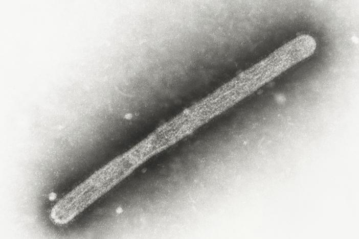 A 2005 electron microscope image shows an avian influenza A H5N1 virion.