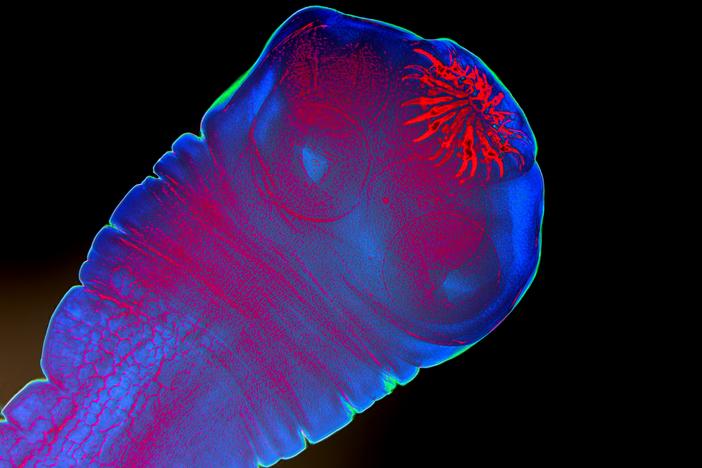 A magnification of the anterior of the larva of the pork tapeworm, showing hooks and suckers. Colors of this image have been manipulated. Parasitic worms made the news after the press reported on a past deposition by Robert F. Kennedy Jr. that he had been infected by a parasitic worm. RFK Jr. did not specify the type of worm but worm researchers believe it could have been a pork tapeworm.