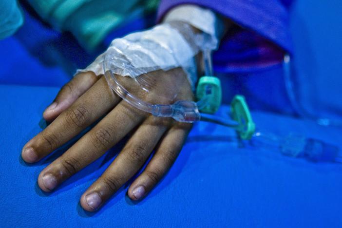 A child undergoing cancer treatment. Countries in the Global South often have far lower survival rates for childhood cancer than in wealthy nations.