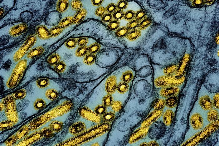 This colorized electron microscope image released by the National Institute of Allergy and Infectious Diseases in March shows avian influenza A H5N1 virus particles (in yellow).