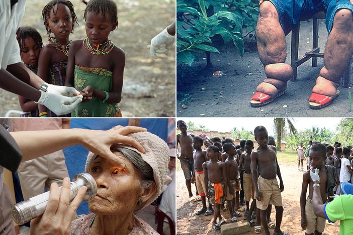 Clockwise from upper left: Nomads from the Peul tribe give blood samples to be tested for sleeping sickness. In 2024, Chad got rid of one form of the disease. Brazil and Timor Leste eliminated lymphatic filariasis, the disfiguring parasite that causes a condition known as elephantiasis. A doctor sees children during a leprosy screening campaign; Jordan eliminated the disease this year. An elderly farmer woman receives an eye exam for trachoma in Vietnam — which along with India and Pakistan — eradicated th…