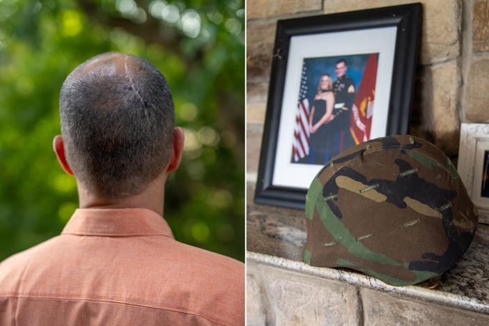 During William Wilcox's service in the Marines, he fired heavy weapons, including shoulder-mounted missile launchers. The blast waves from those weapons may have led to an arteriovenous malformation (AVM) in his brain. As a result of the malformation and subsequent surgery, he now has epilepsy, memory problems, and other symptoms.