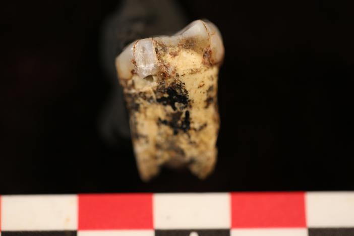 One of the teeth from seven <em>Australopithecus</em> individuals that got drilled so a small amount of tooth enamel could be analyzed for evidence of meat consumption.