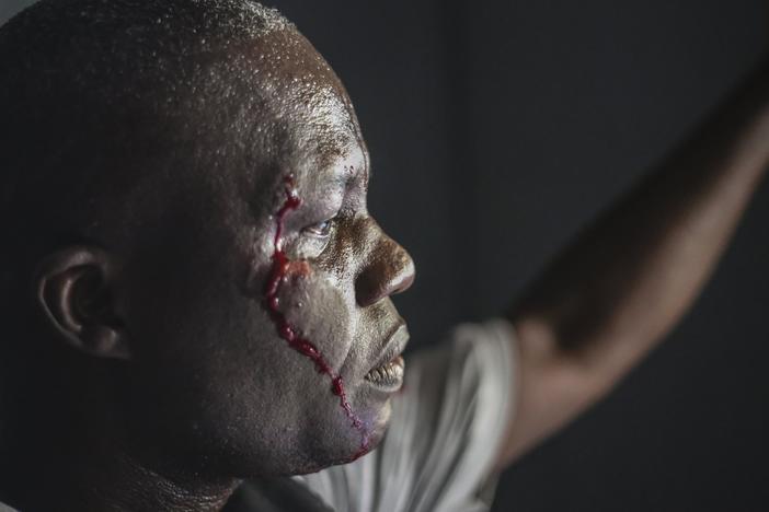 A wounded security officer looks on after being shot by armed gangs at the General Hospital in Port-au-Prince, Haiti, Tuesday, Dec. 24, 2024.