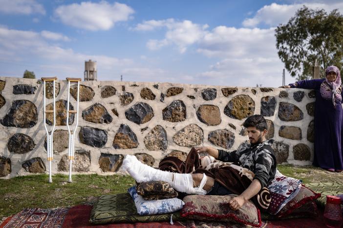 A young man who was shot by the Israeli military during a protest against the Israeli presence rests his leg outside his home on Jan. 2 in Golan Heights, Syria. Since the fall of Bashar al-Assad, the Israel military has taken new positions in Golan Heights areas.