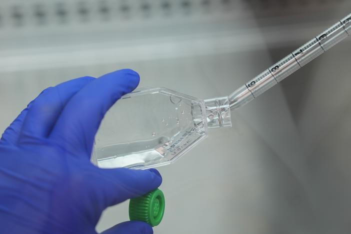 Lung tissue samples that will be used in research are prepared at the University of Toledo in Toledo, Ohio on Sept. 5, 2024.