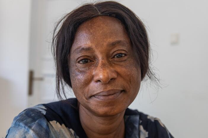 Susan Anderson began using skin lightening creams at age 12. Now 52, she has stopped using the products but her skin shows the damage they caused.