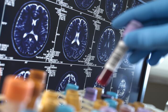 New tests of blood and spinal fluid could help doctors quickly identify patients who would most benefit from treatment.