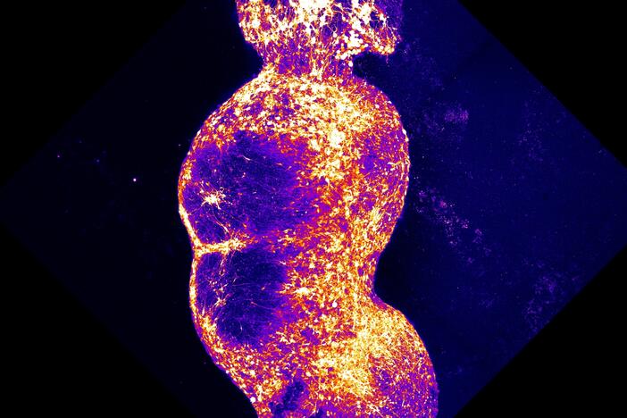 Researchers integrated four organoids that represent the four components of the human sensory pathway, along which pain signals are conveyed to the brain. Stimulation of the sensory organoid (top) by substances, such as capsaicin, triggers neuronal activity that is then transmitted throughout the rest of the organoids.