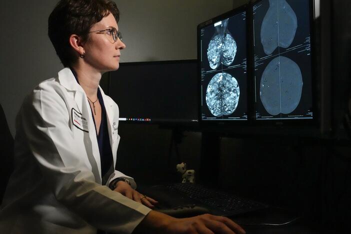 Dr. Olena Weaver of MD Anderson Cancer Center in Houston looks at mammogram imagery. The regular mammogram on the left shows a woman with dense breast tissue; on the right is a <a href="https://www.mdanderson.org/cancerwise/what-is-a-contrast-enhanced-mammogram.h00-159701490.html"target="_blank"   >contrast-enhanced mammogram</a>.
