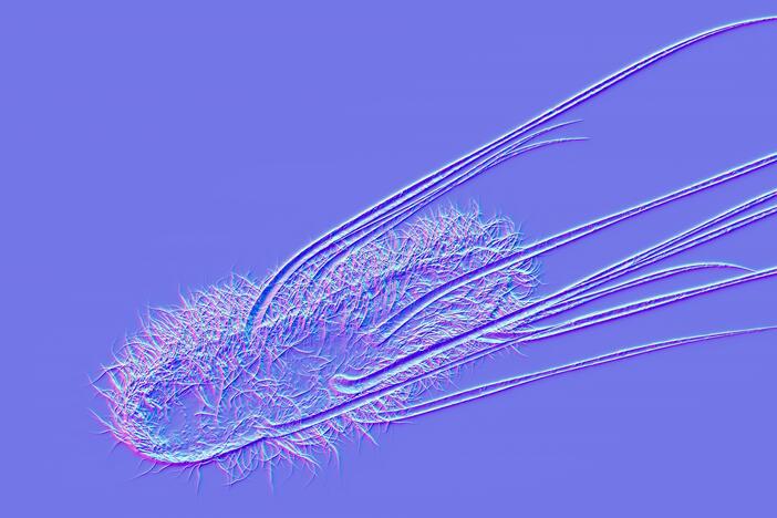 Escherichia coli or E. coli is a part of family of bacteria that are commonly found in the human gut. Scientists found that a toxin the bacteria release is linked to some cases of colorectal cancer.