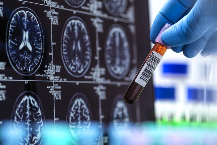 The first Alzheimer's blood test cleared by the Food And Drug Administration is set to make diagnosis more accessible and accurate — and change the way doctors treat the disease.
