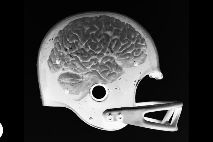 Are Concussions Deadly?: asset-mezzanine-16x9