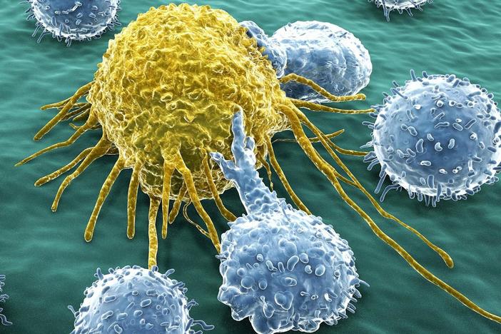 Why Do So Many People Get Cancer?: asset-mezzanine-16x9