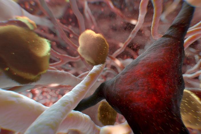 Can Alzheimer's Be Stopped?: asset-mezzanine-16x9