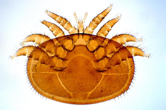 Varroa Mites Are a Honeybee's 8-Legged Nightmare: asset-mezzanine-16x9