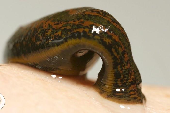 Take Two Leeches and Call Me in the Morning: asset-mezzanine-16x9