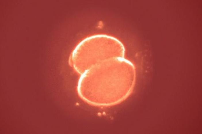 In the Race for Life, Which Human Embryos Make It? : asset-mezzanine-16x9
