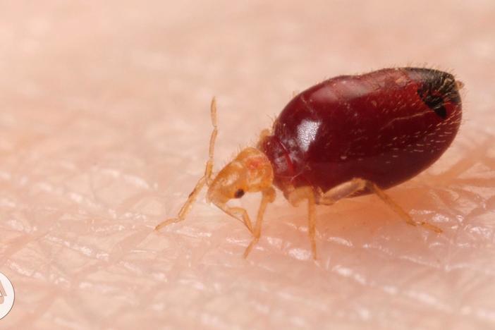 Watch Bed Bugs Get Stopped in Their Tracks: asset-mezzanine-16x9