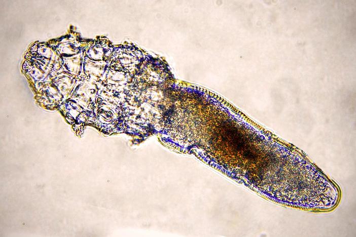 These Face Mites Really Grow on You: asset-mezzanine-16x9