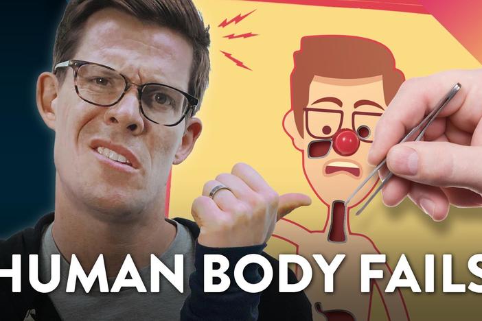 Evolution Fails in the Human Body: asset-mezzanine-16x9