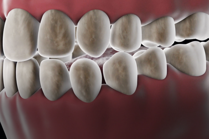 The 40 Million-Year-Old Ecosystem In Your Mouth: asset-mezzanine-16x9
