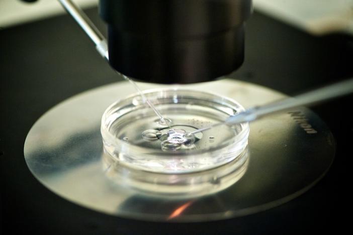 Ivf (Photo By BSIP/UIG Via Getty Images)